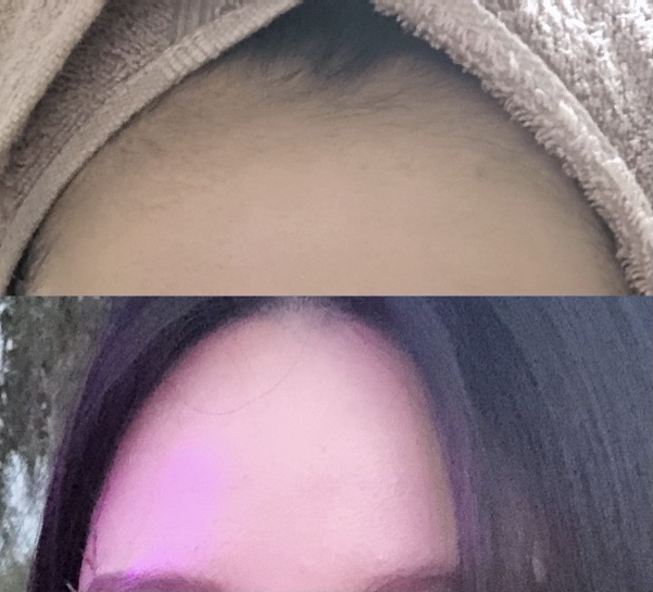 여우피부 photo 8