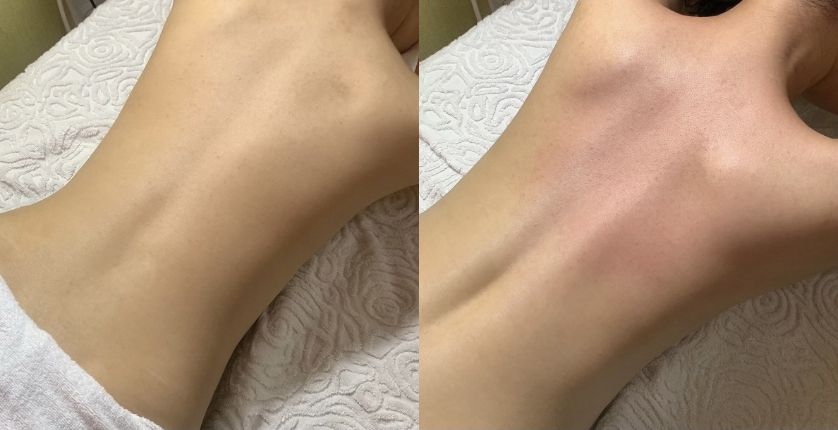 여우피부 photo 2