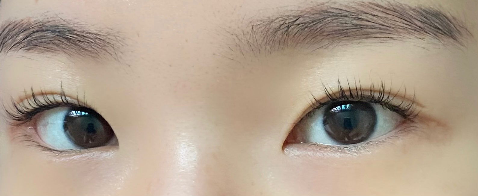 여우피부 photo 5