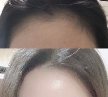 여우피부 photo 7