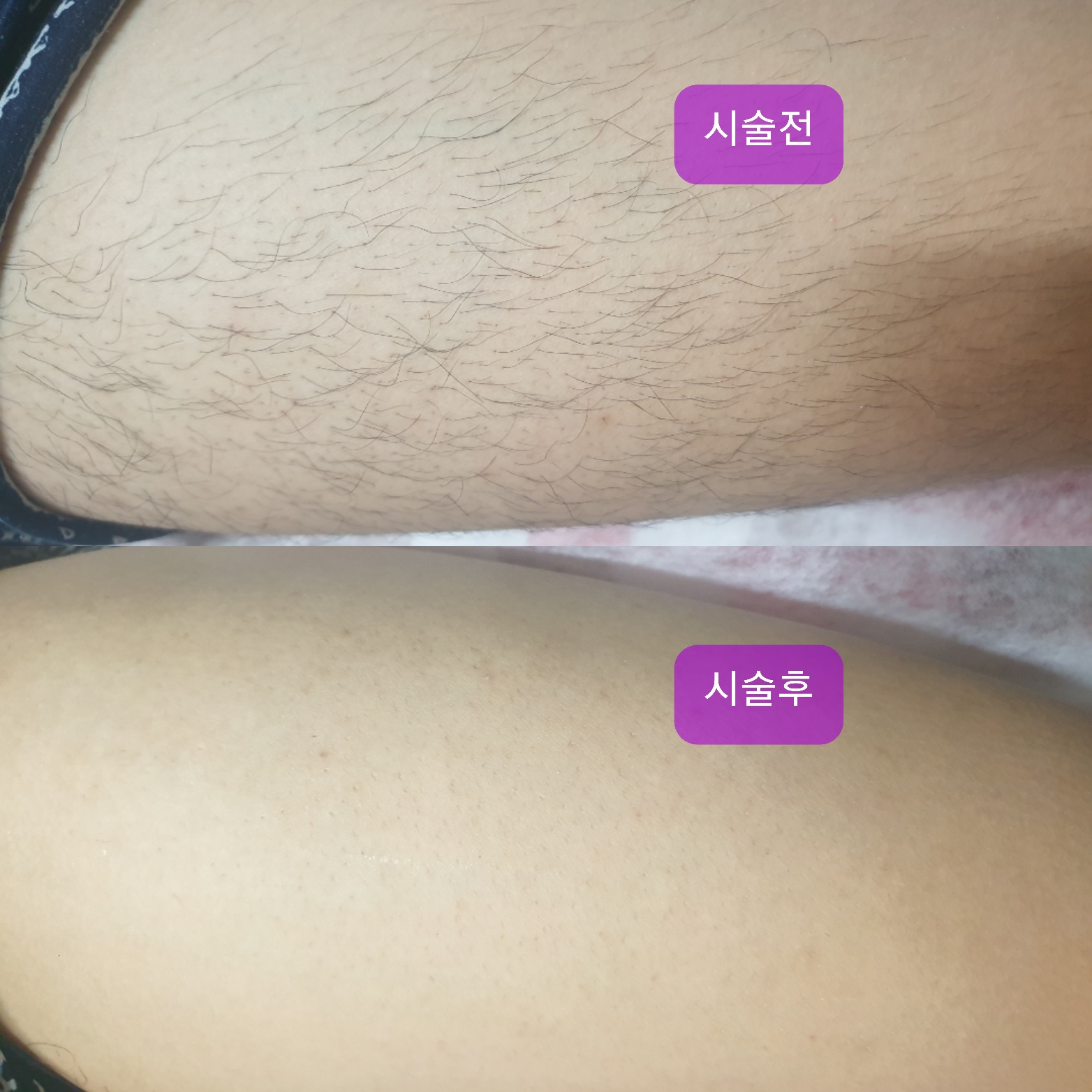 더 이쁨 photo 5
