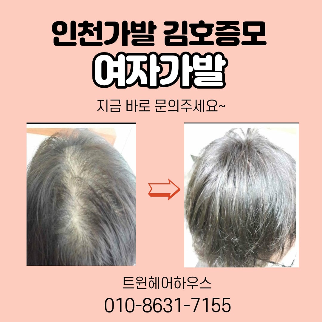 김호증모 가발전문샵 by 트윈헤어하우스