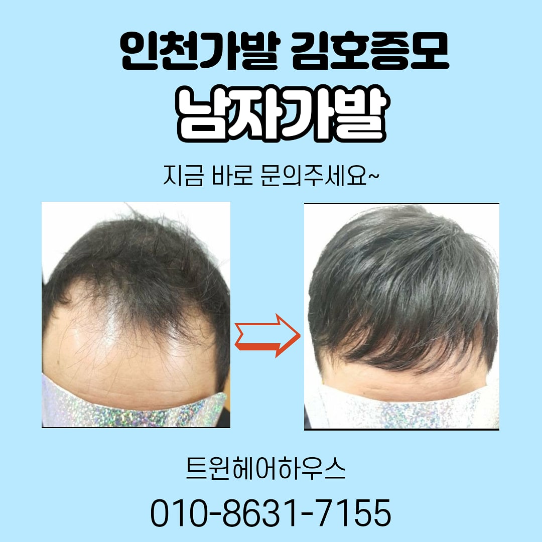 김호증모 가발전문샵 by 트윈헤어하우스
