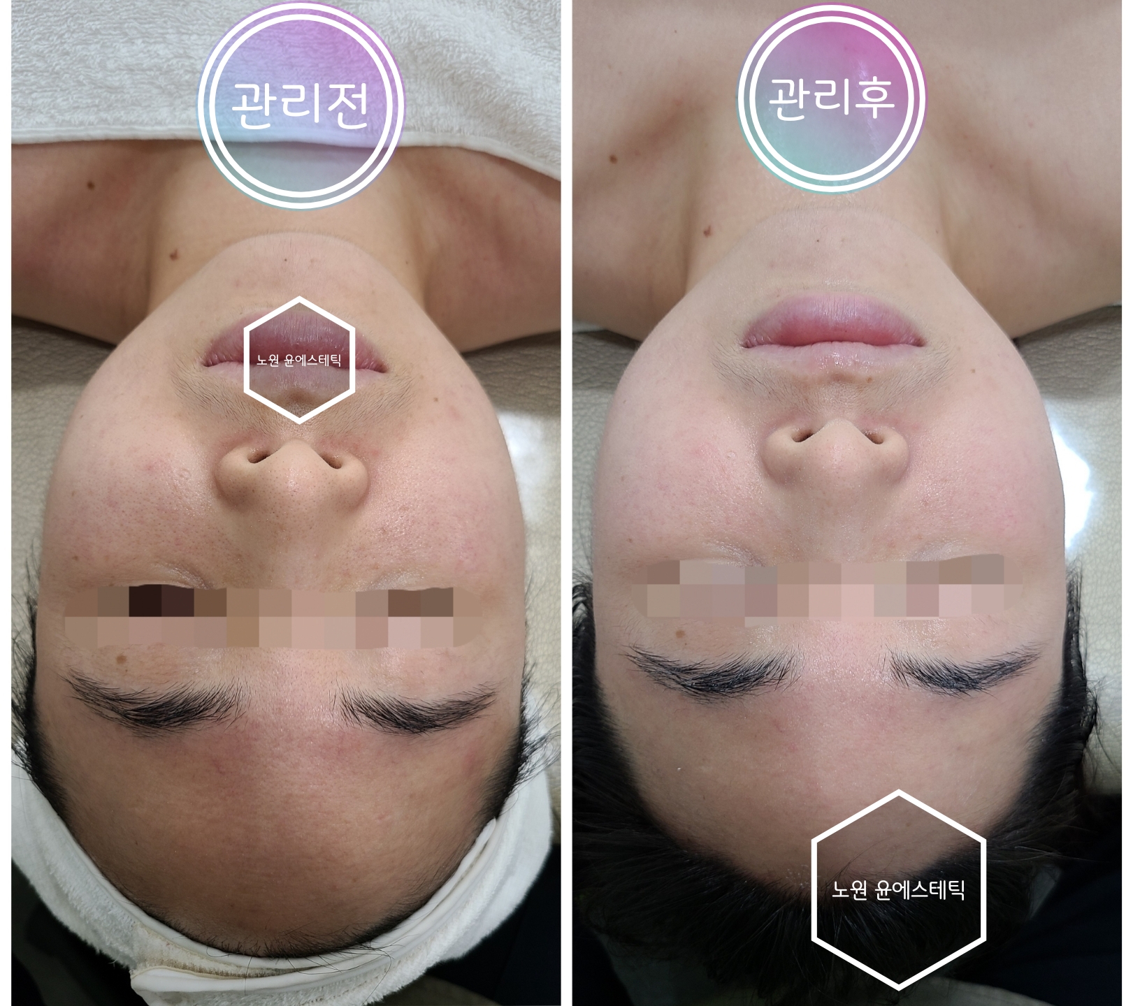 윤에스테틱 노원본점