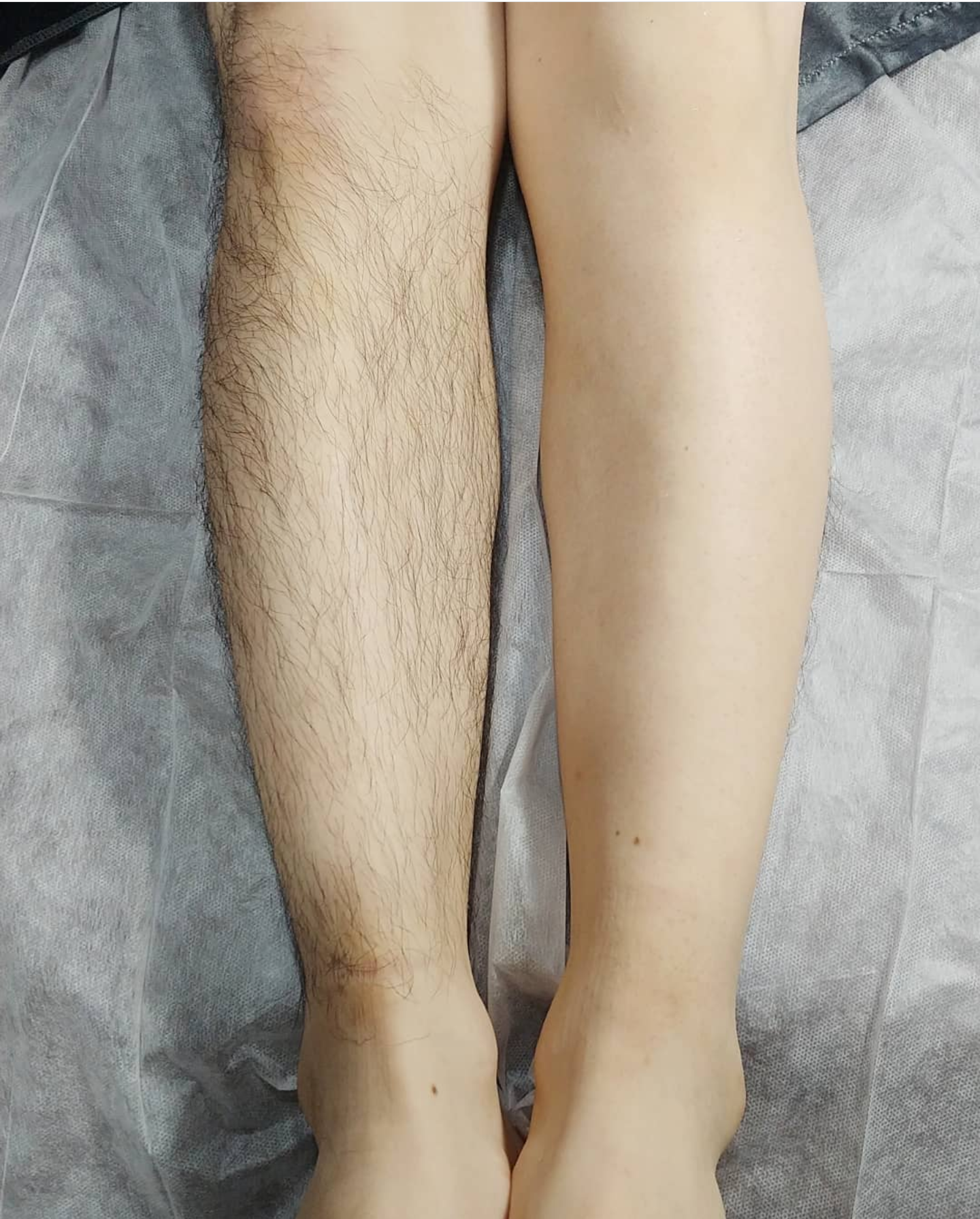 브라운왁싱 대표 이미지