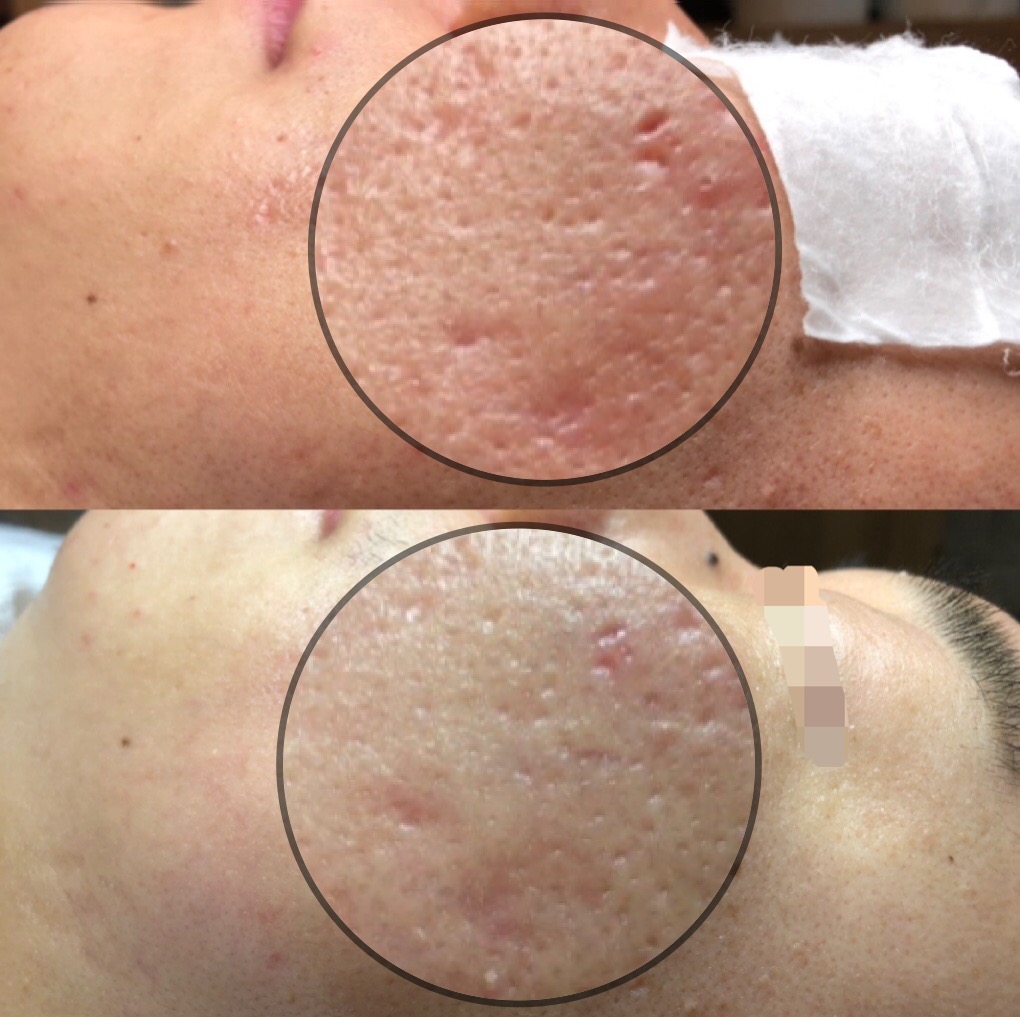 원스킨케어 대표 이미지