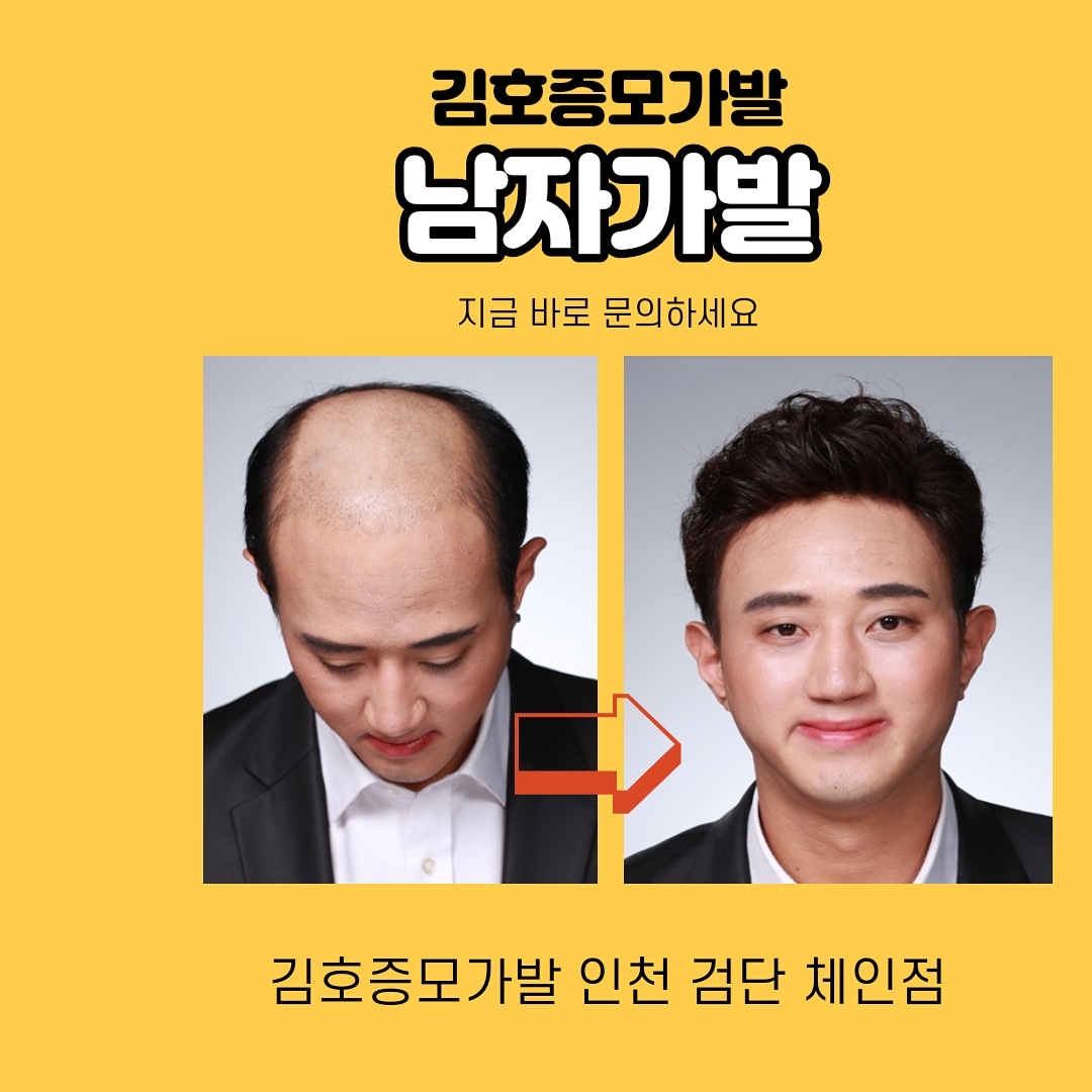 김호증모가발 도도헤어