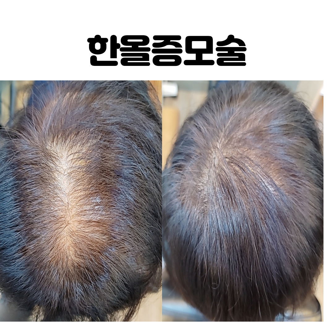 김호증모가발by헤어코디