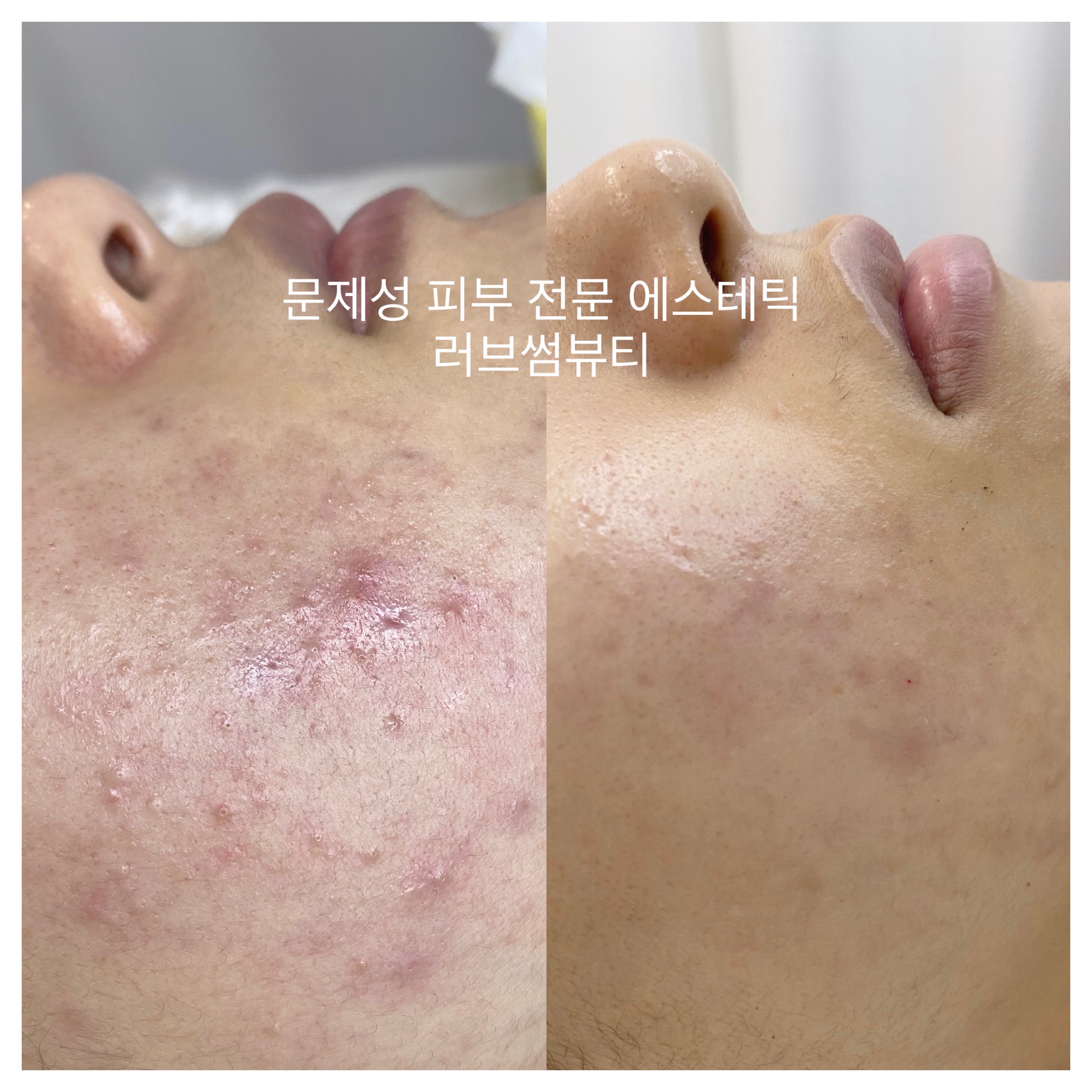 러브썸뷰티샵 대표 이미지