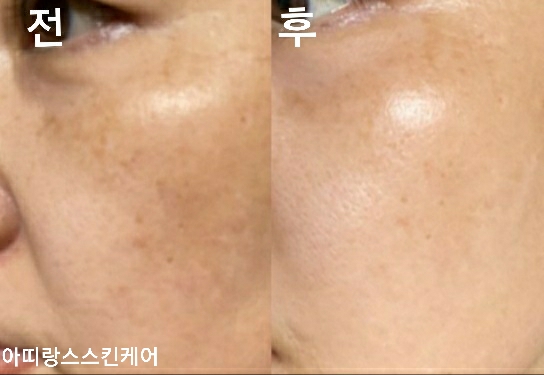 아띠랑스
