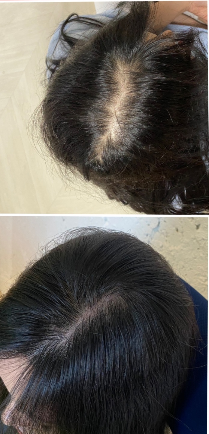 FACE채우다 대표 이미지