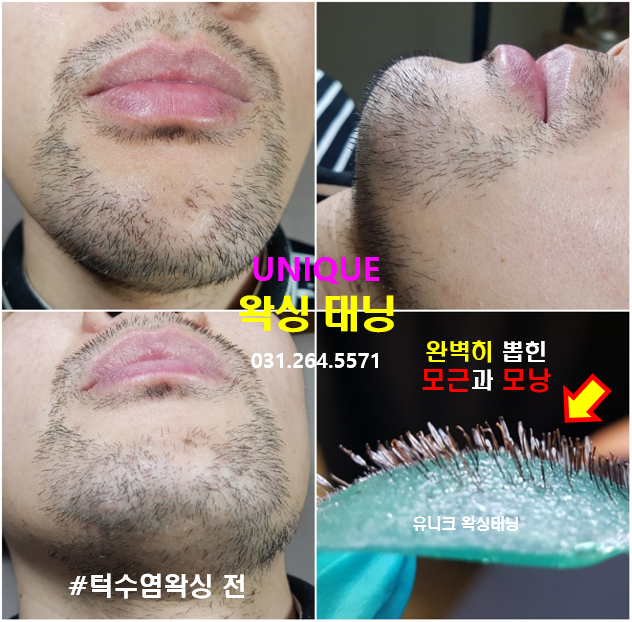 유니크 왁싱태닝 대표 이미지