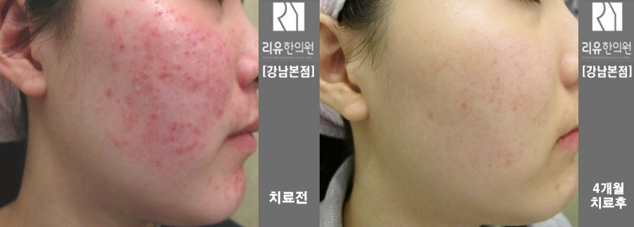 리유한의원 강남본점 대표 이미지