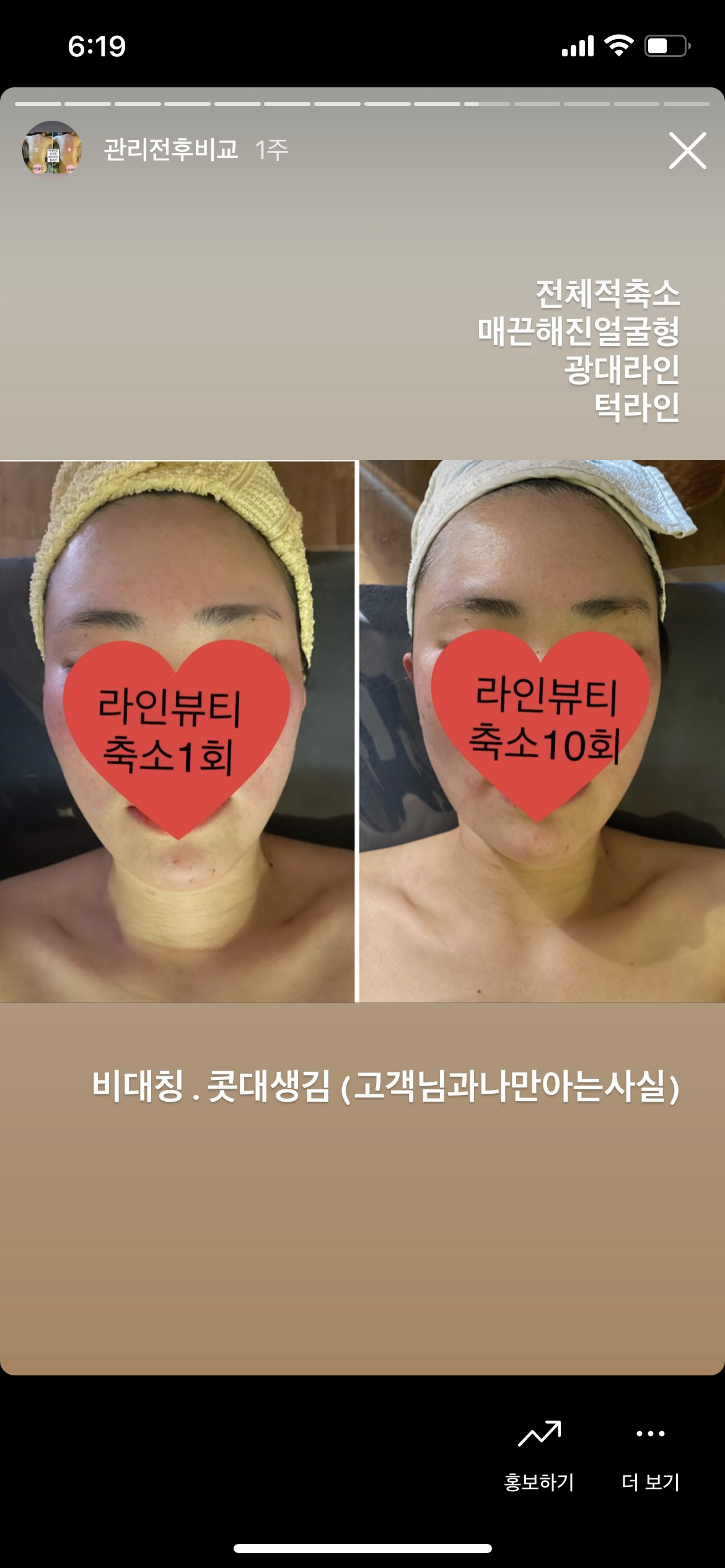 라인뷰티에스테틱