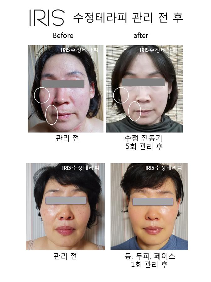 이조은에스테틱 진주혁신점