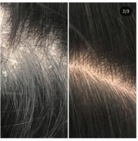 리원스탈모 대표 이미지