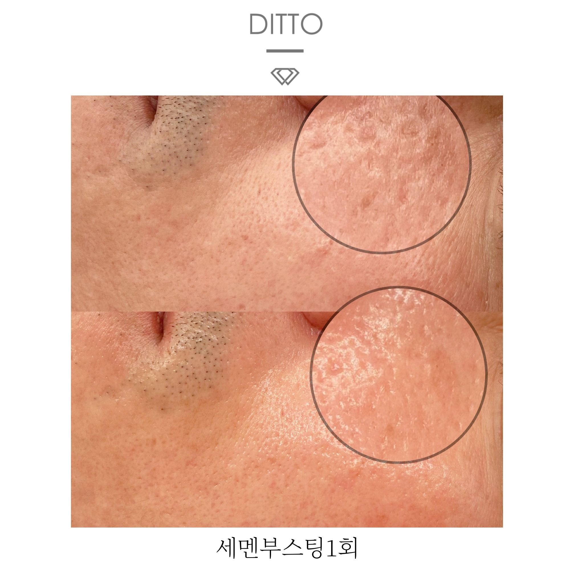 디또뷰티 평택본점