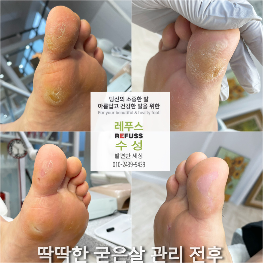 레푸스 수성점
