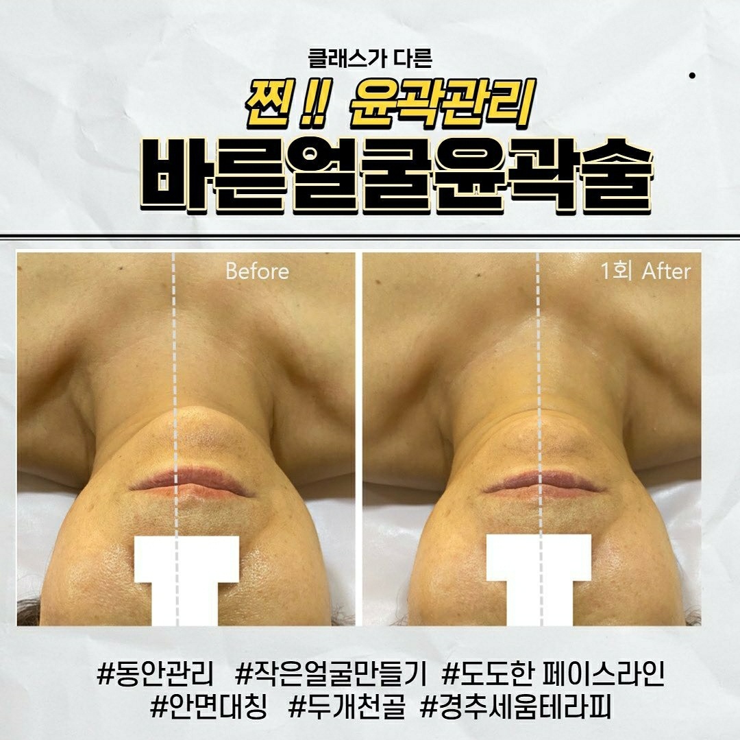 하테라피 photo 9