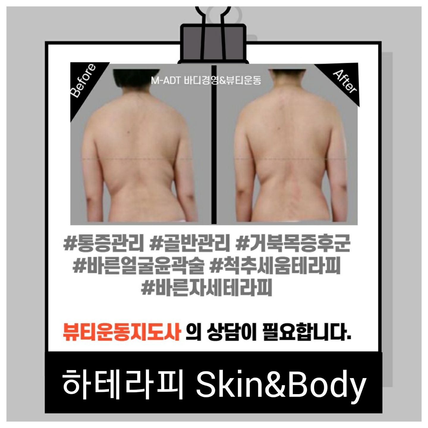 하테라피 대표 이미지