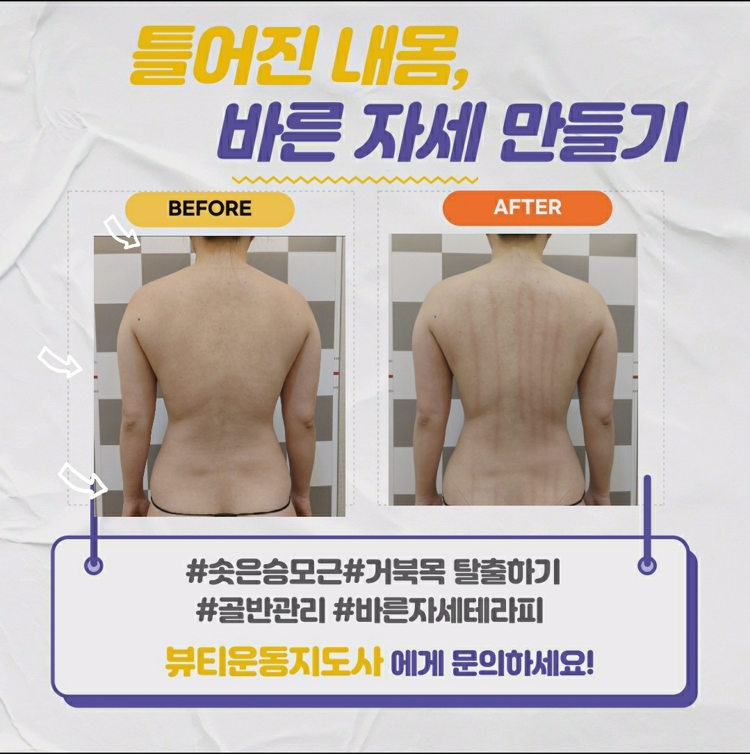 하테라피 대표 이미지