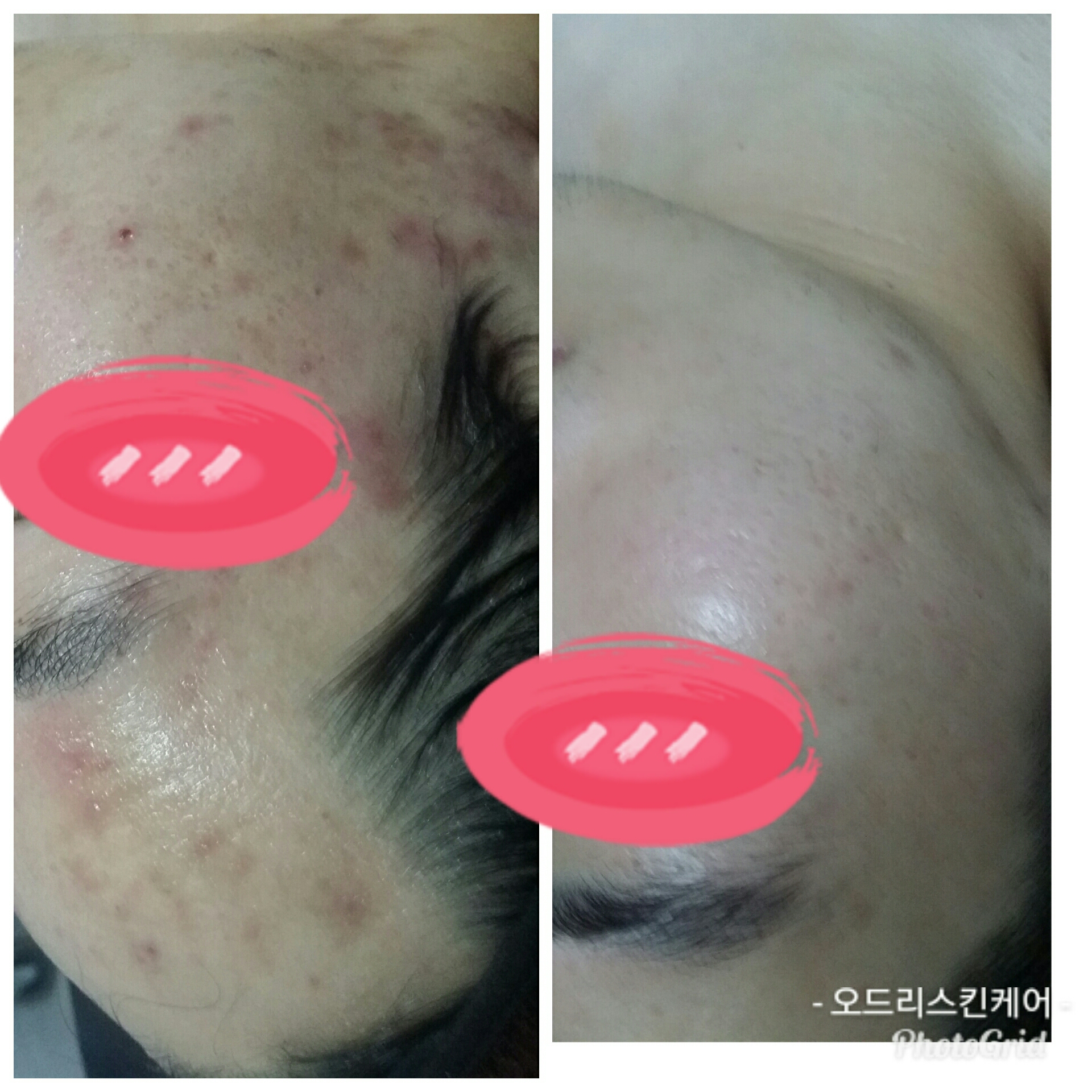 오드리피부관리샵 대표 이미지