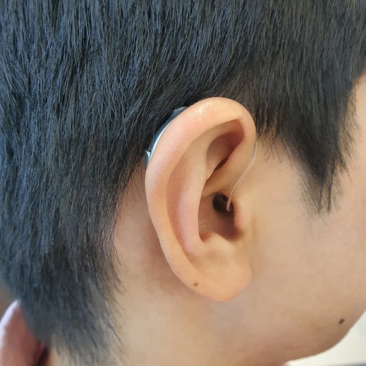 다비치보청기 명일역점