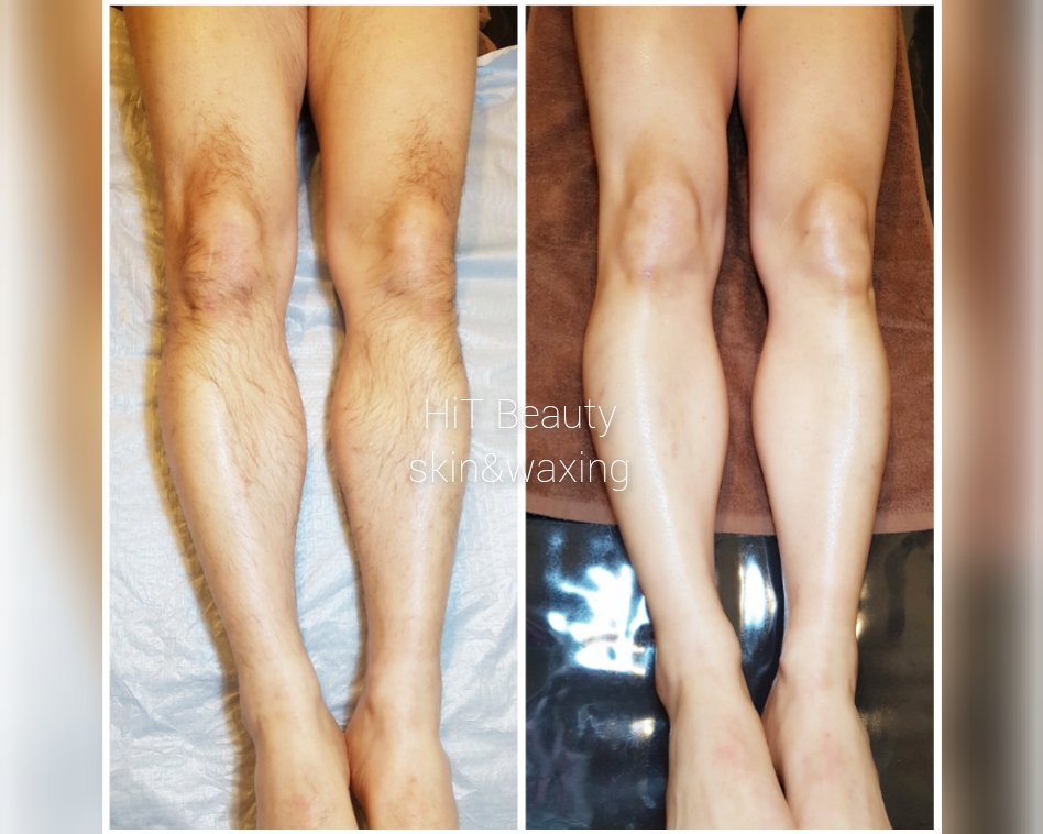 히트뷰티왁싱 대표 이미지