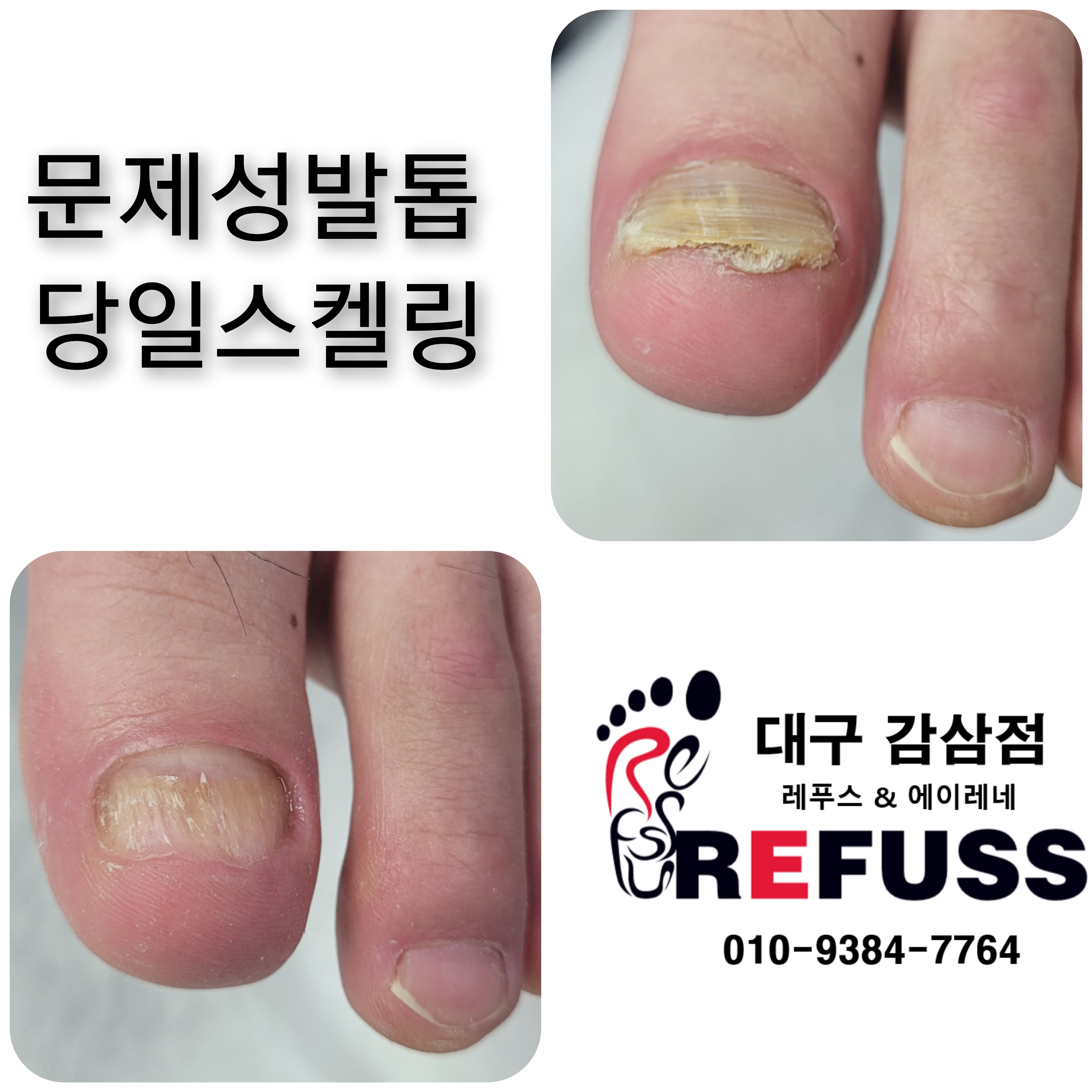 레푸스감삼점&에이레네