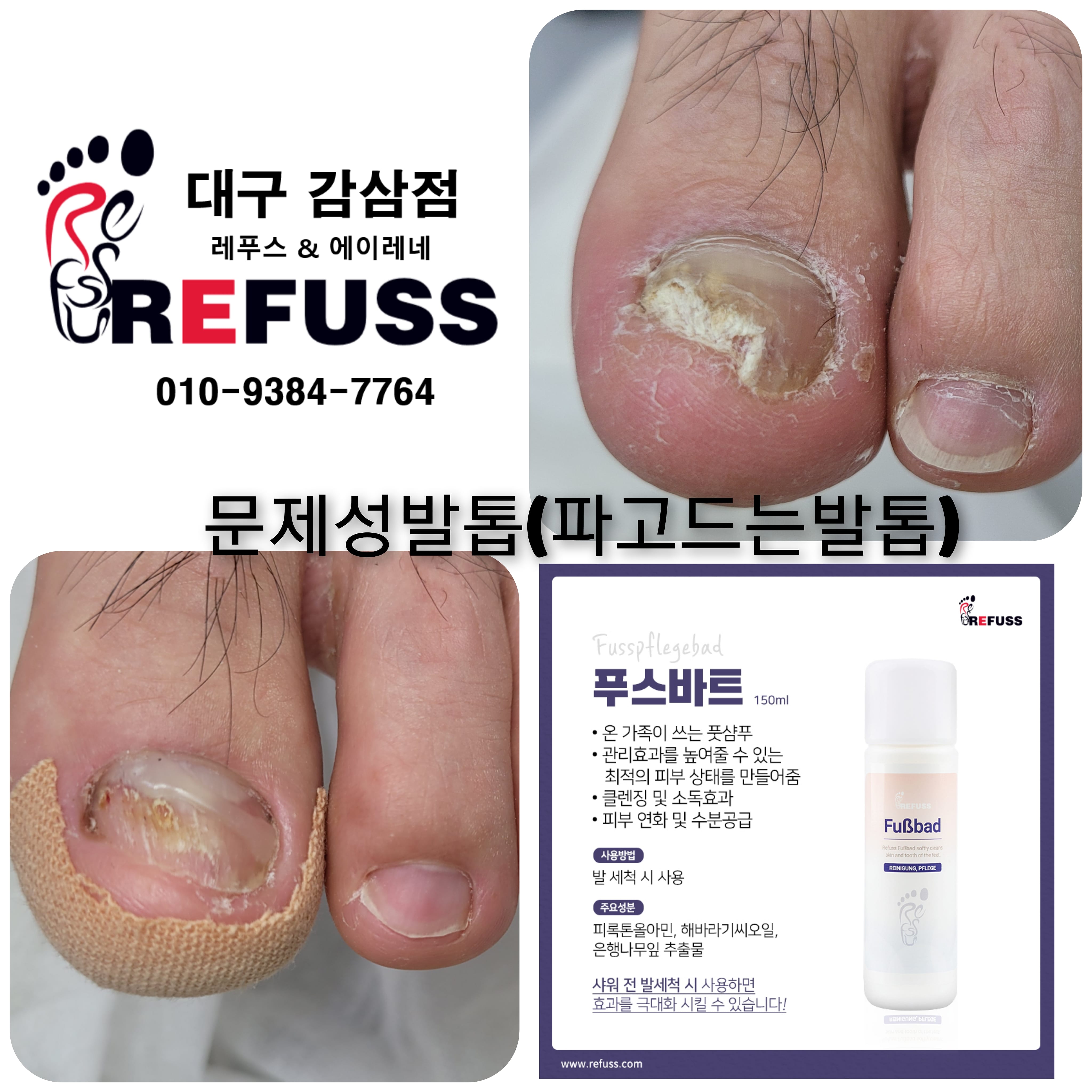 레푸스감삼점&에이레네