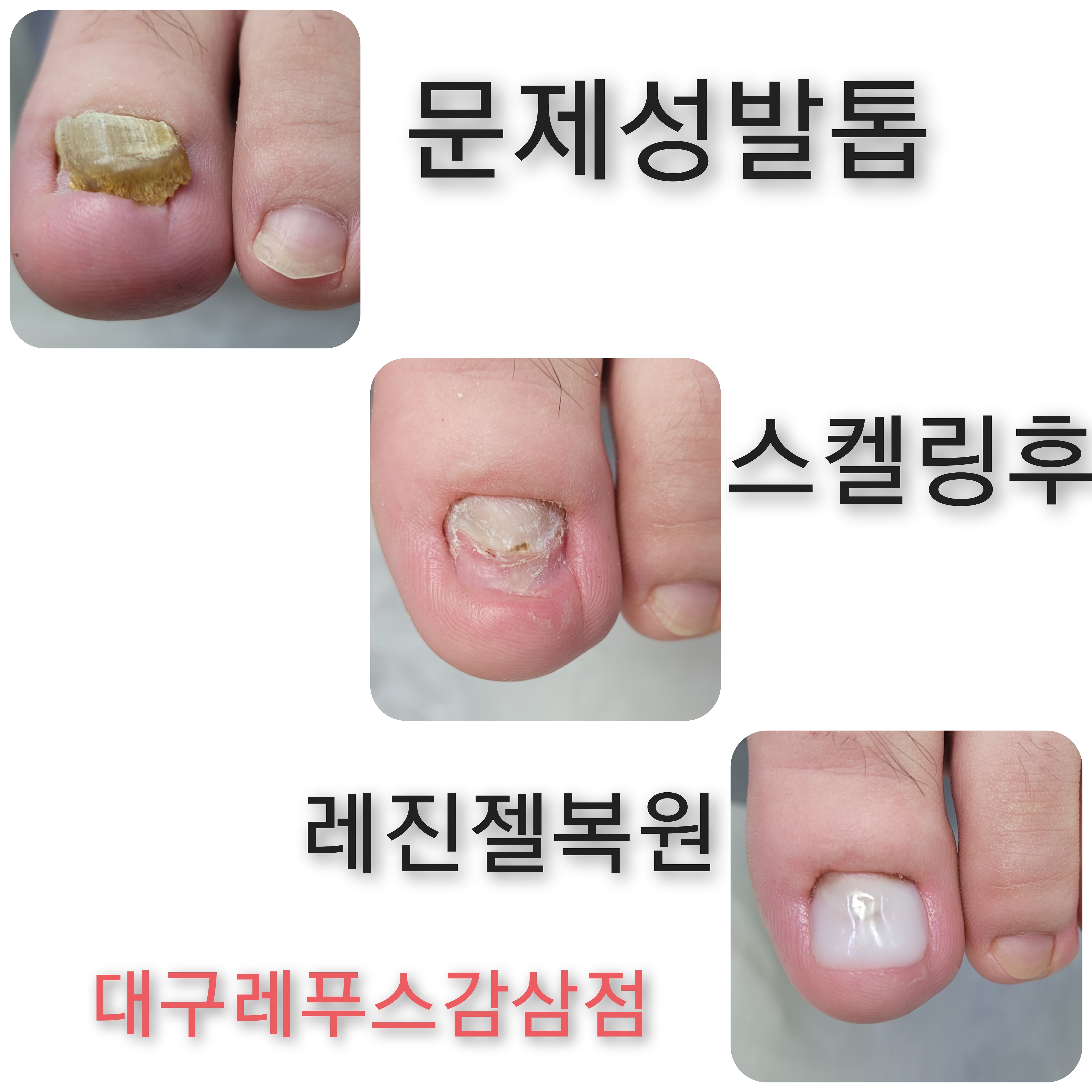 레푸스감삼점&에이레네