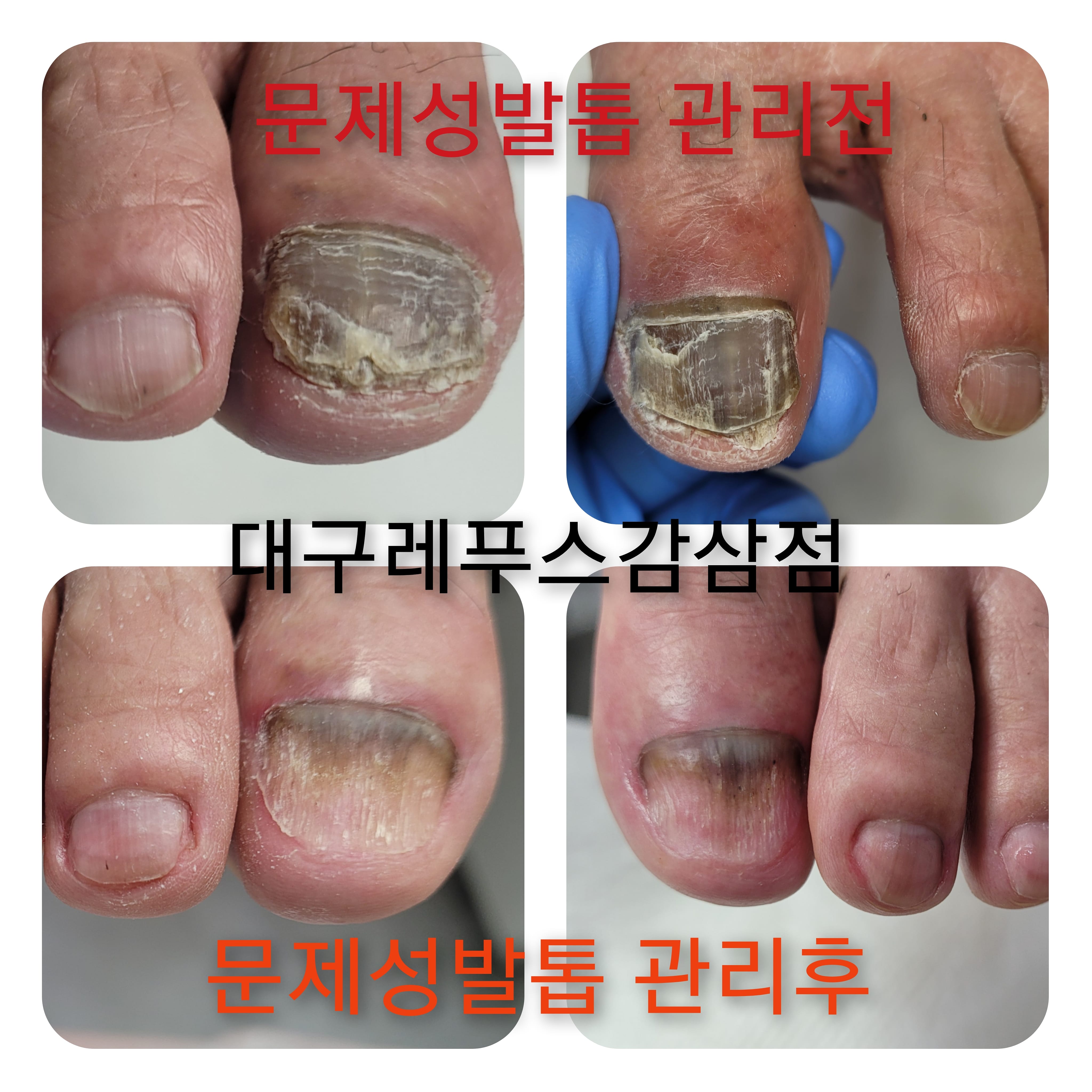 레푸스감삼점&에이레네