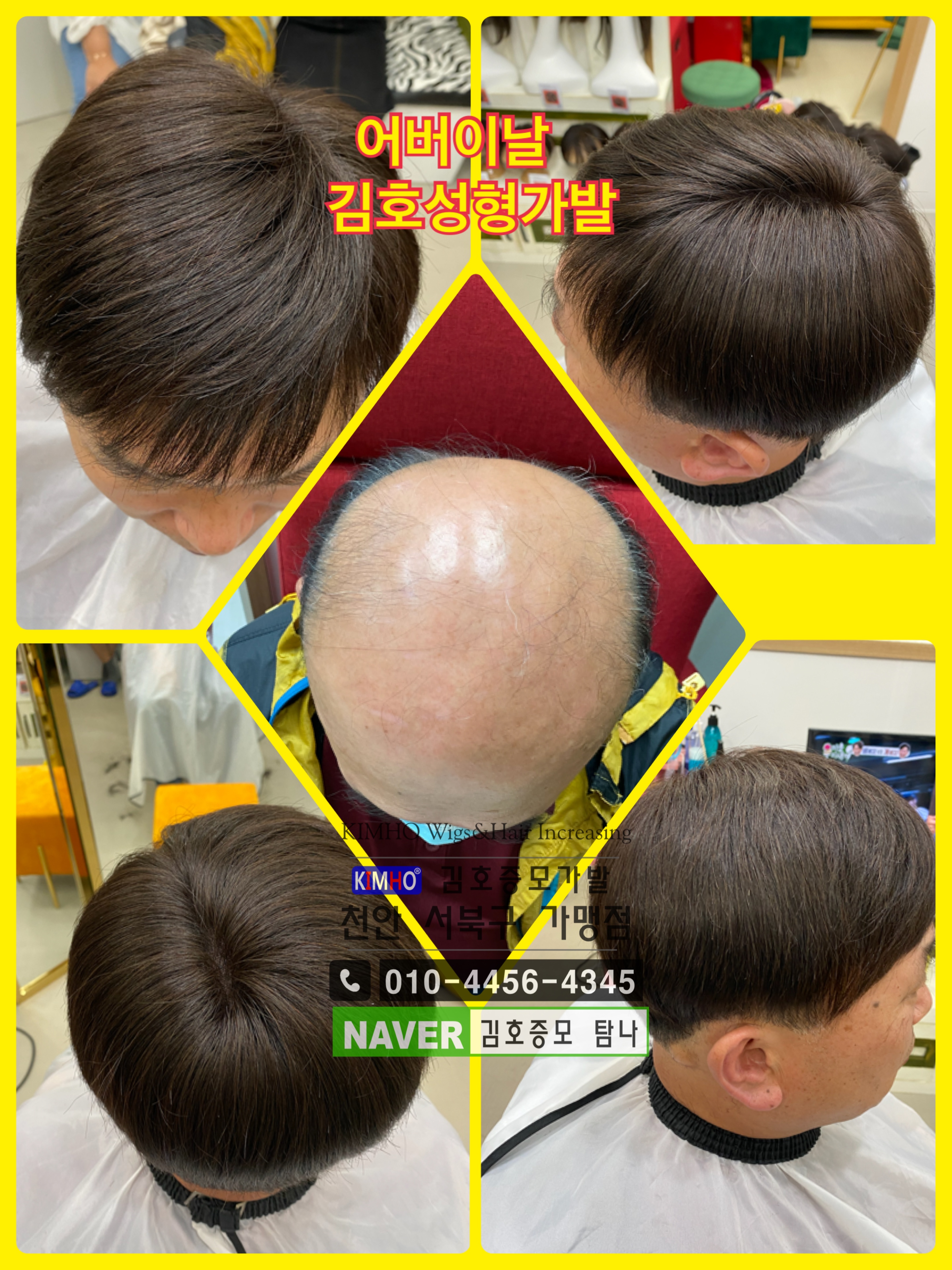 김호증모가발 탐나