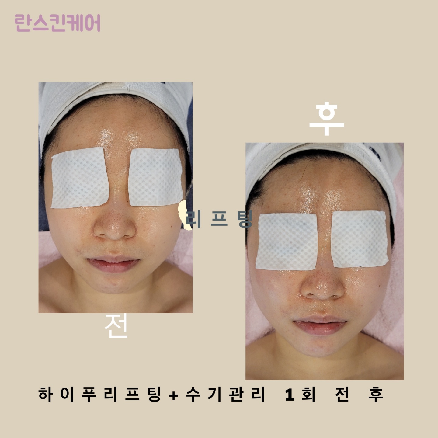 부천중동 란스킨케어