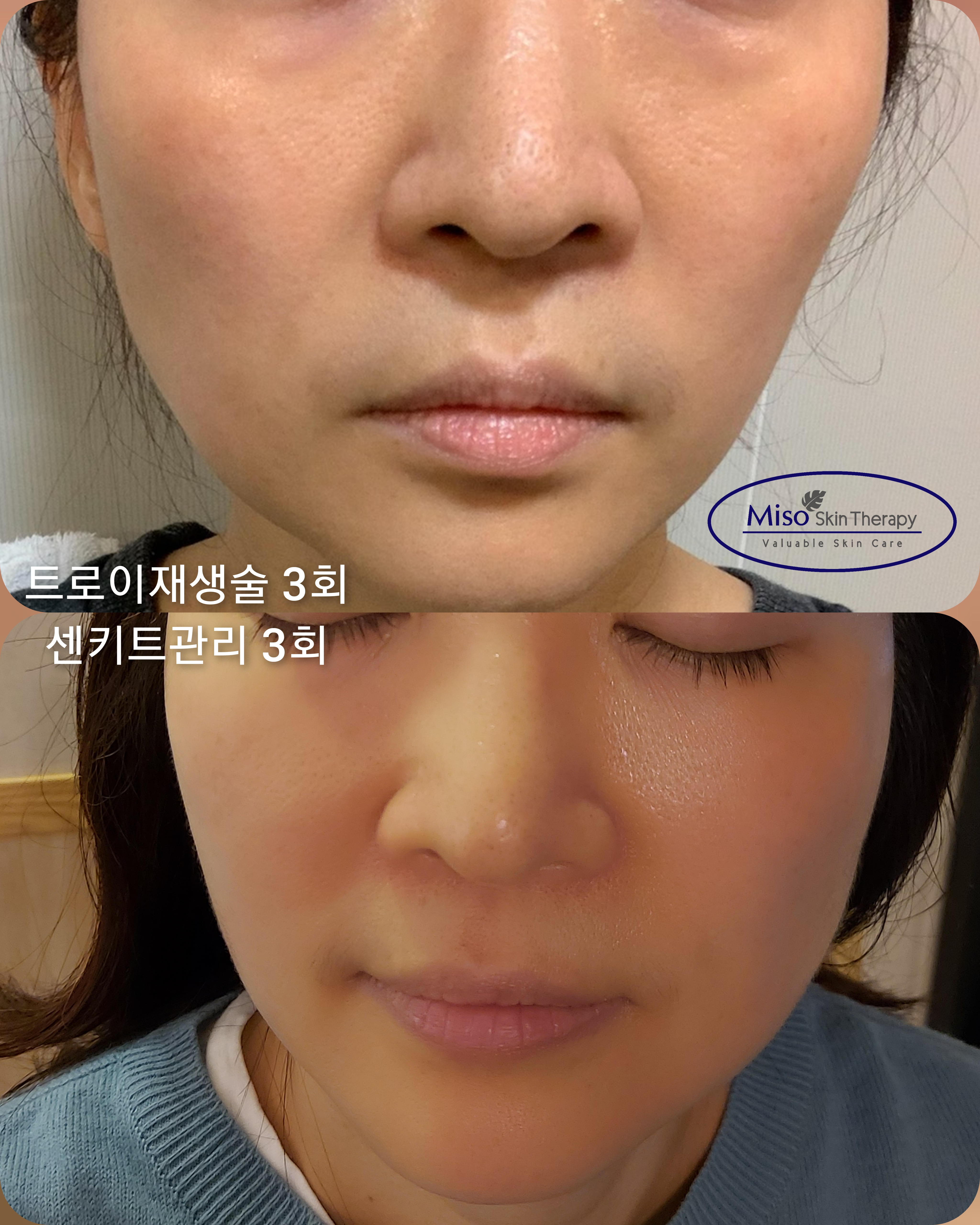 미소피부