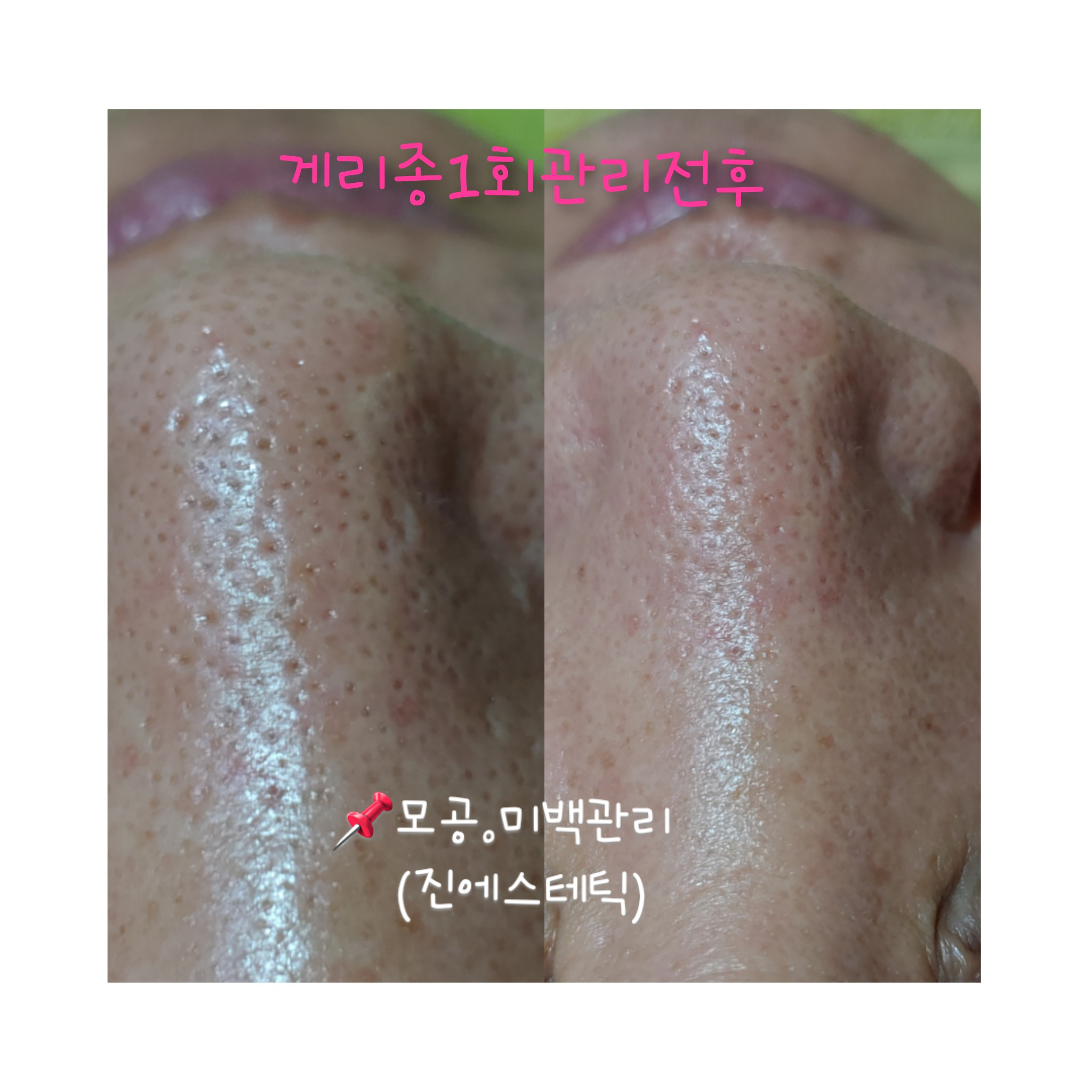 진에스테틱