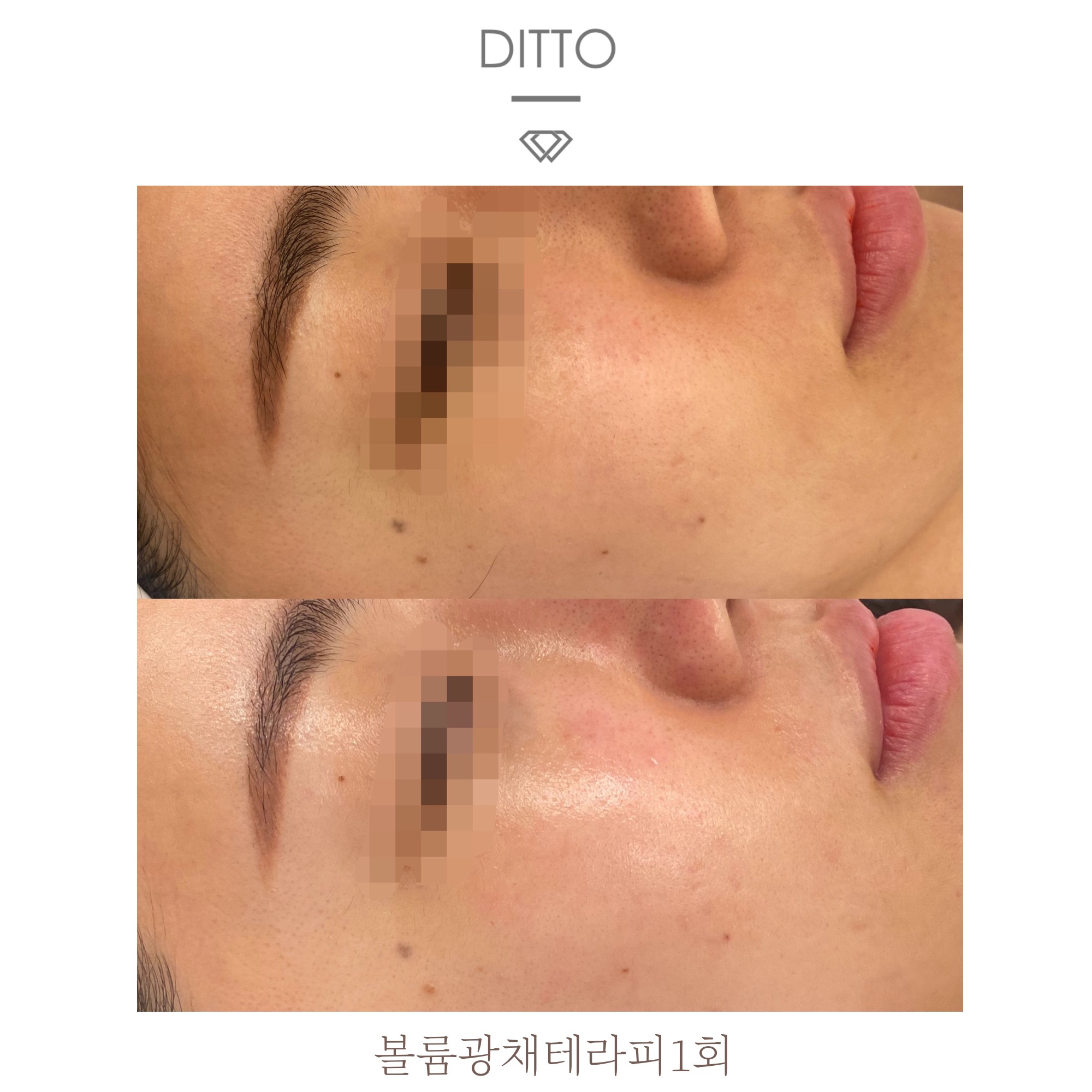디또뷰티 평택본점