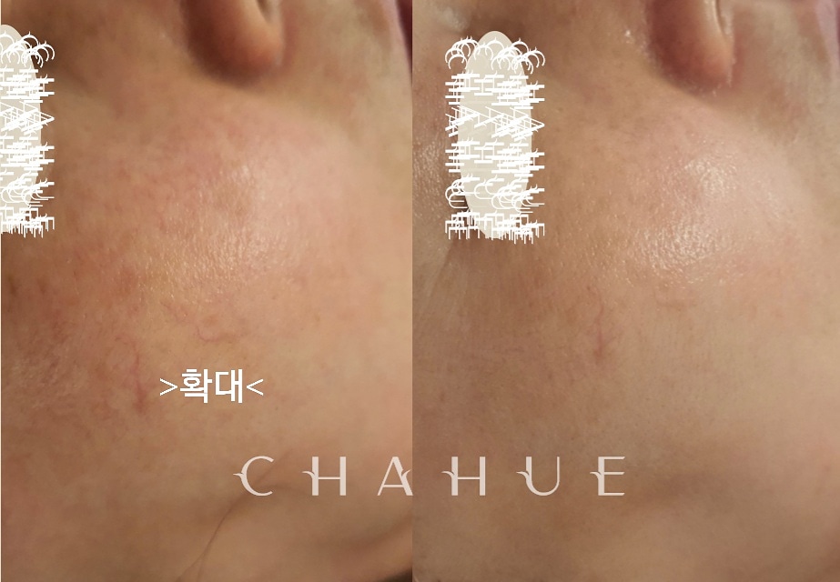 약손체형관리