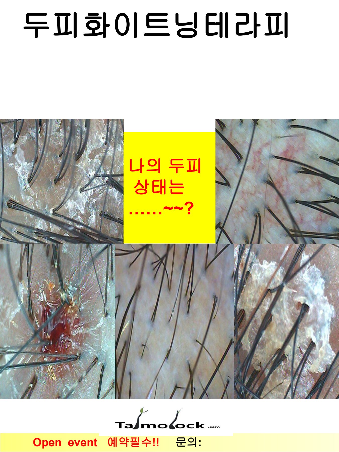 이아소에스떼