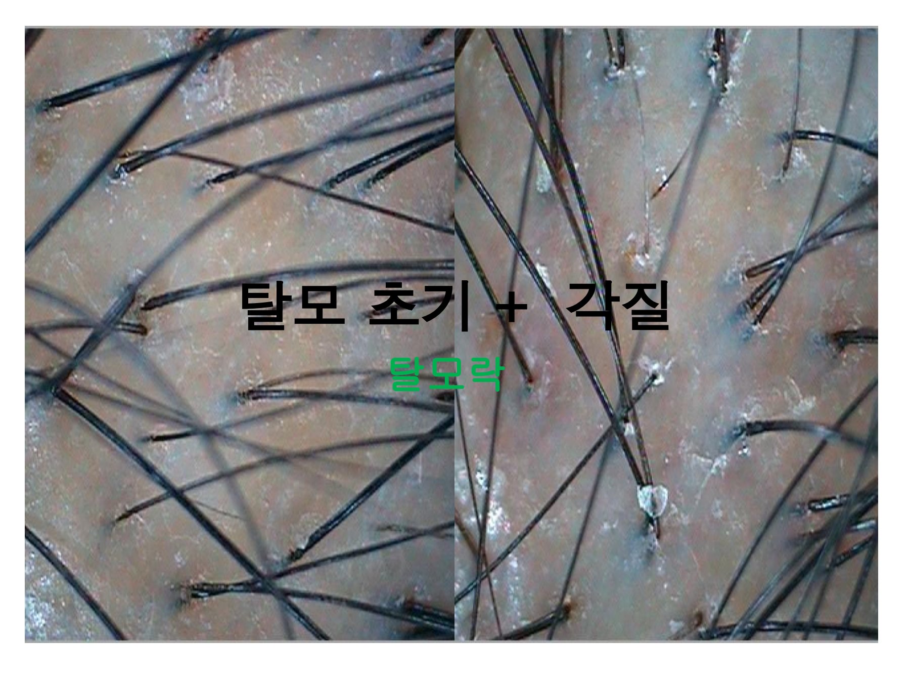 이아소에스떼