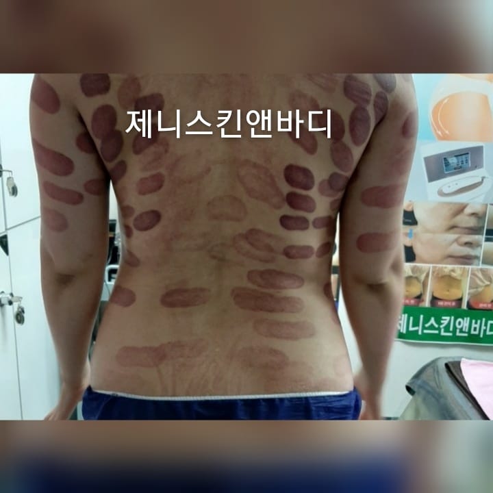 제니스킨앤바디