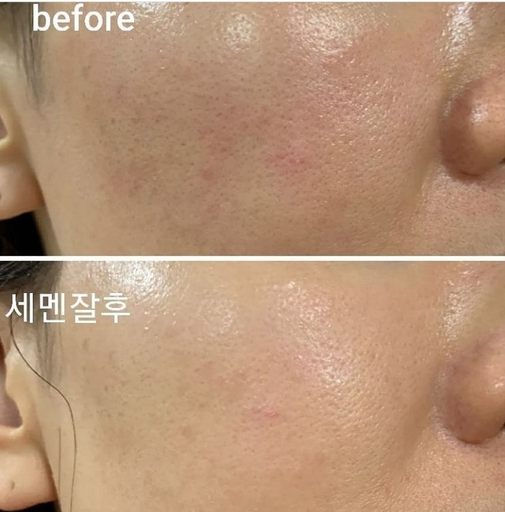 새온뷰티 두골비얼굴축소연구소