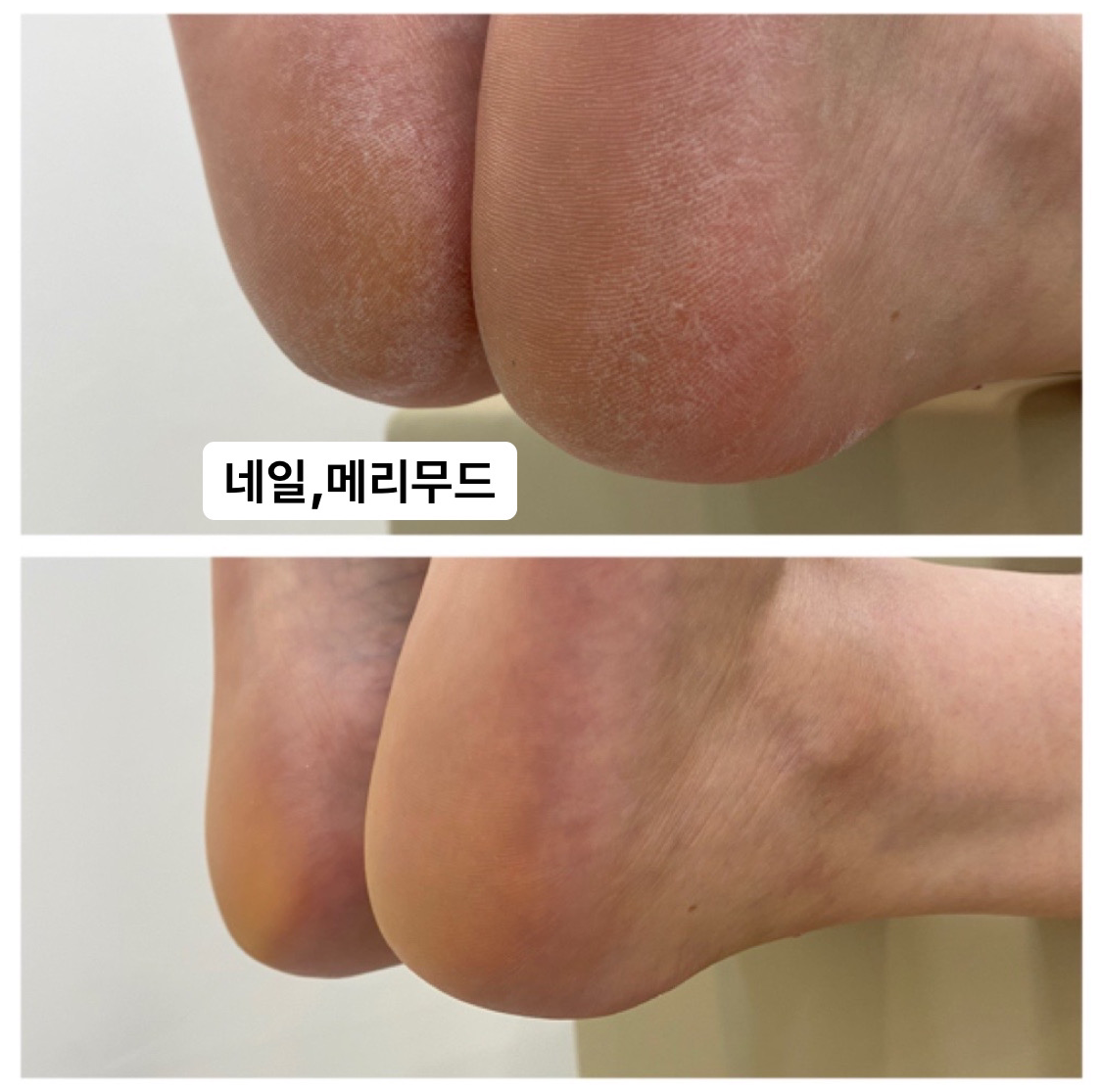 네일메리무드