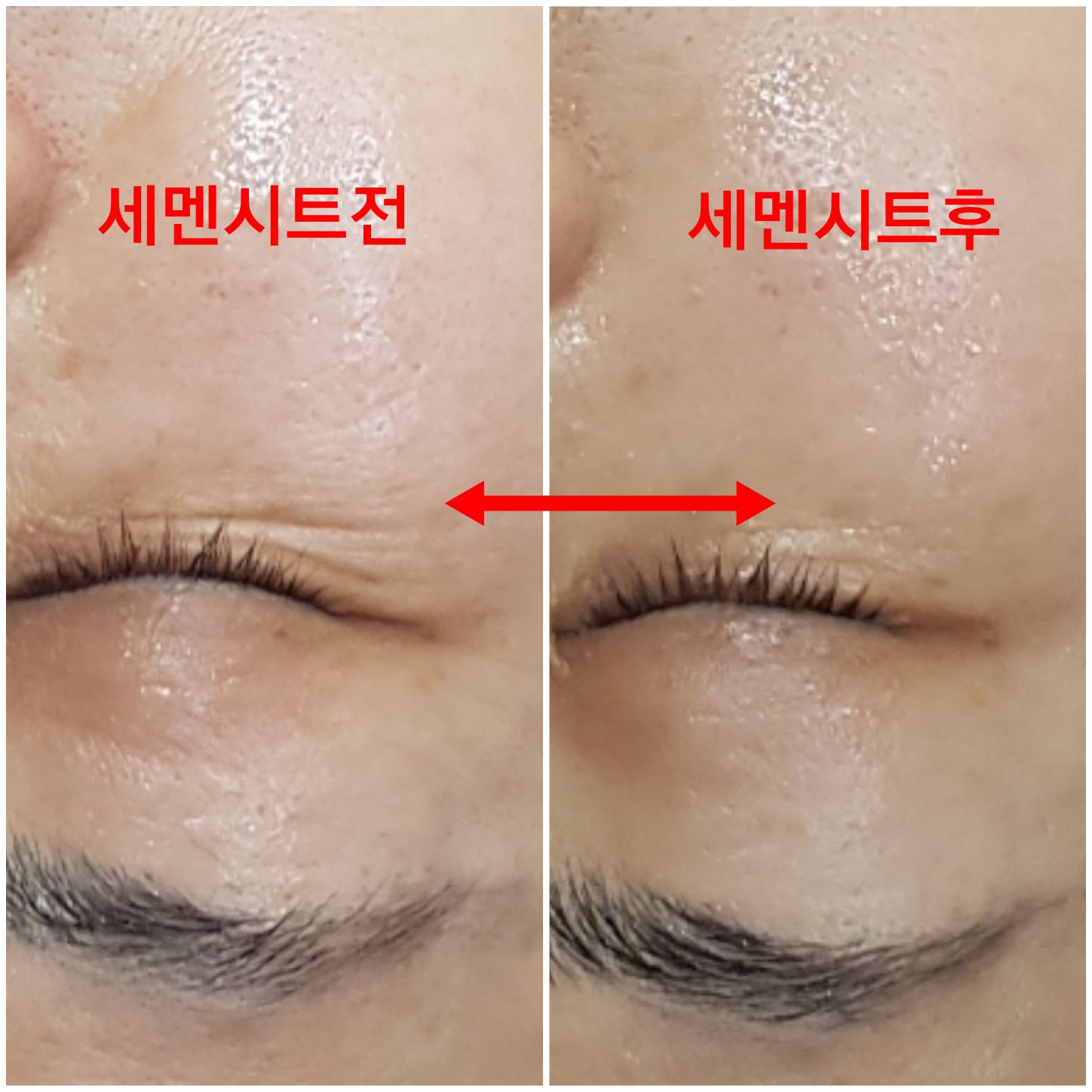 새온뷰티 두골비얼굴축소연구소