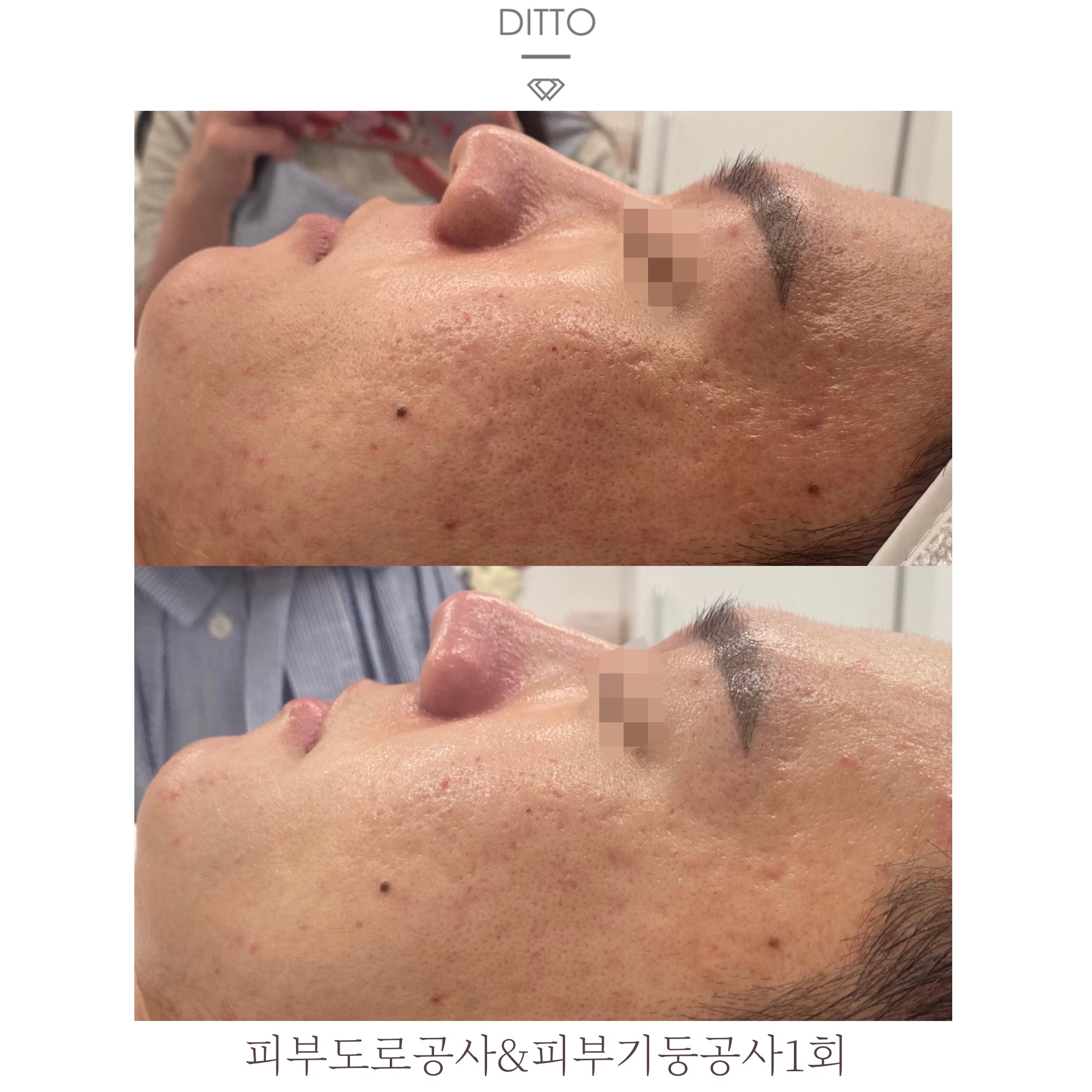 디또뷰티 평택본점