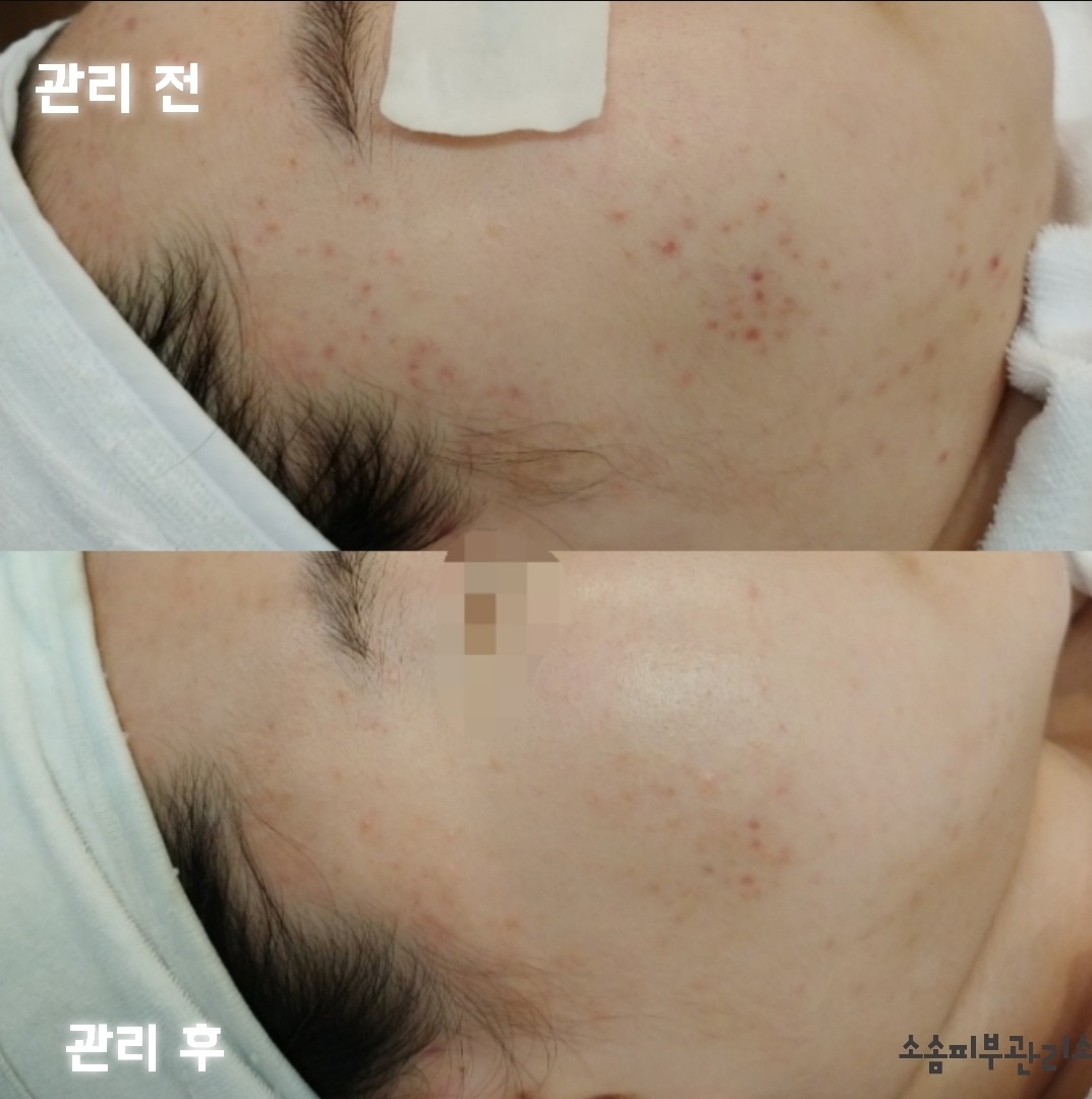 소솜피부관리소 대표 이미지