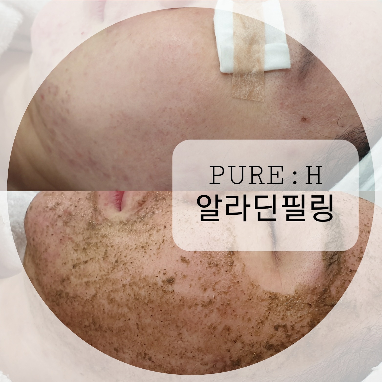 판교왁싱&피부 리메이크 photo 7