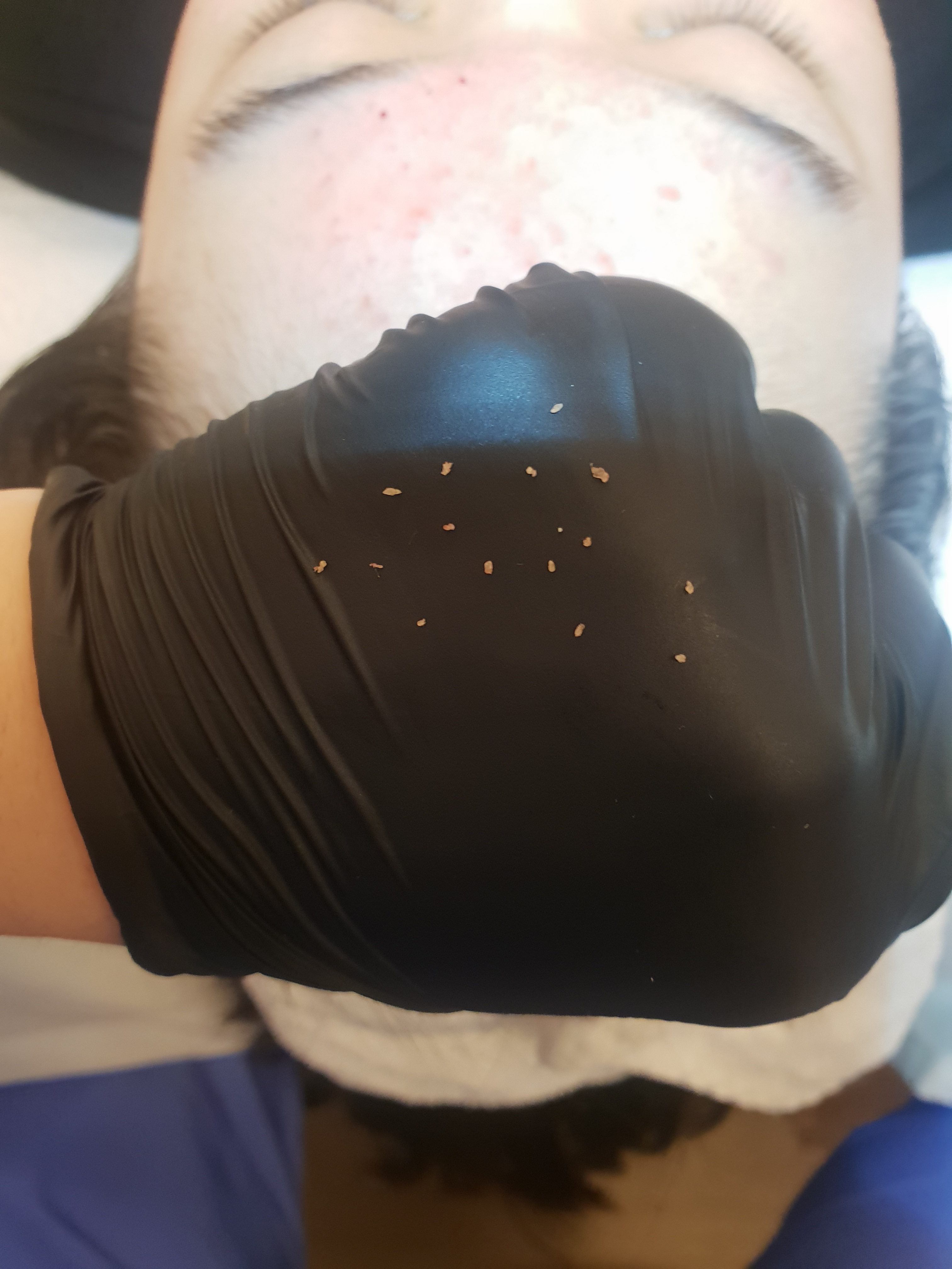 휴스테틱 대표 이미지