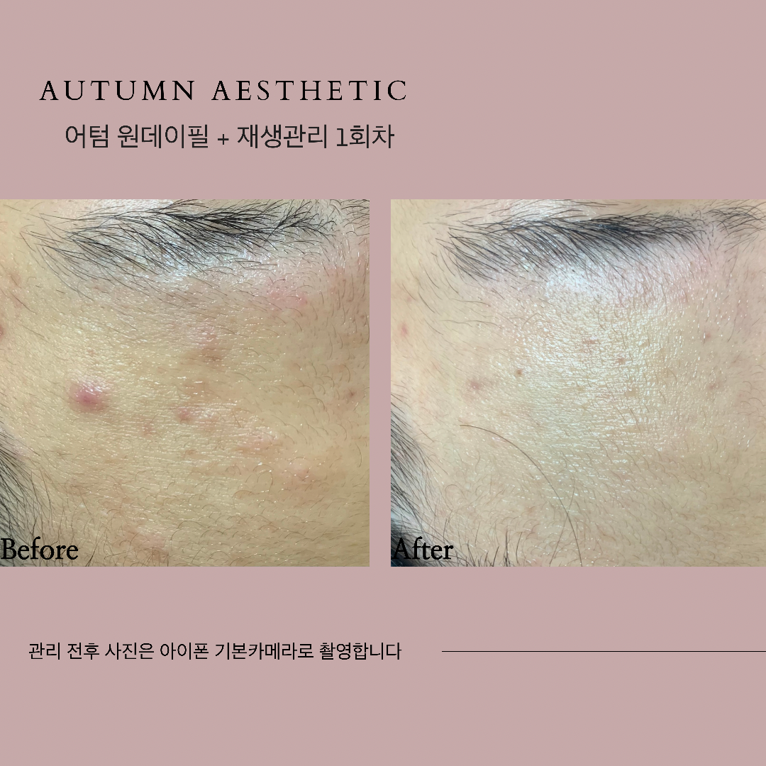 어텀에스테틱 대표 이미지
