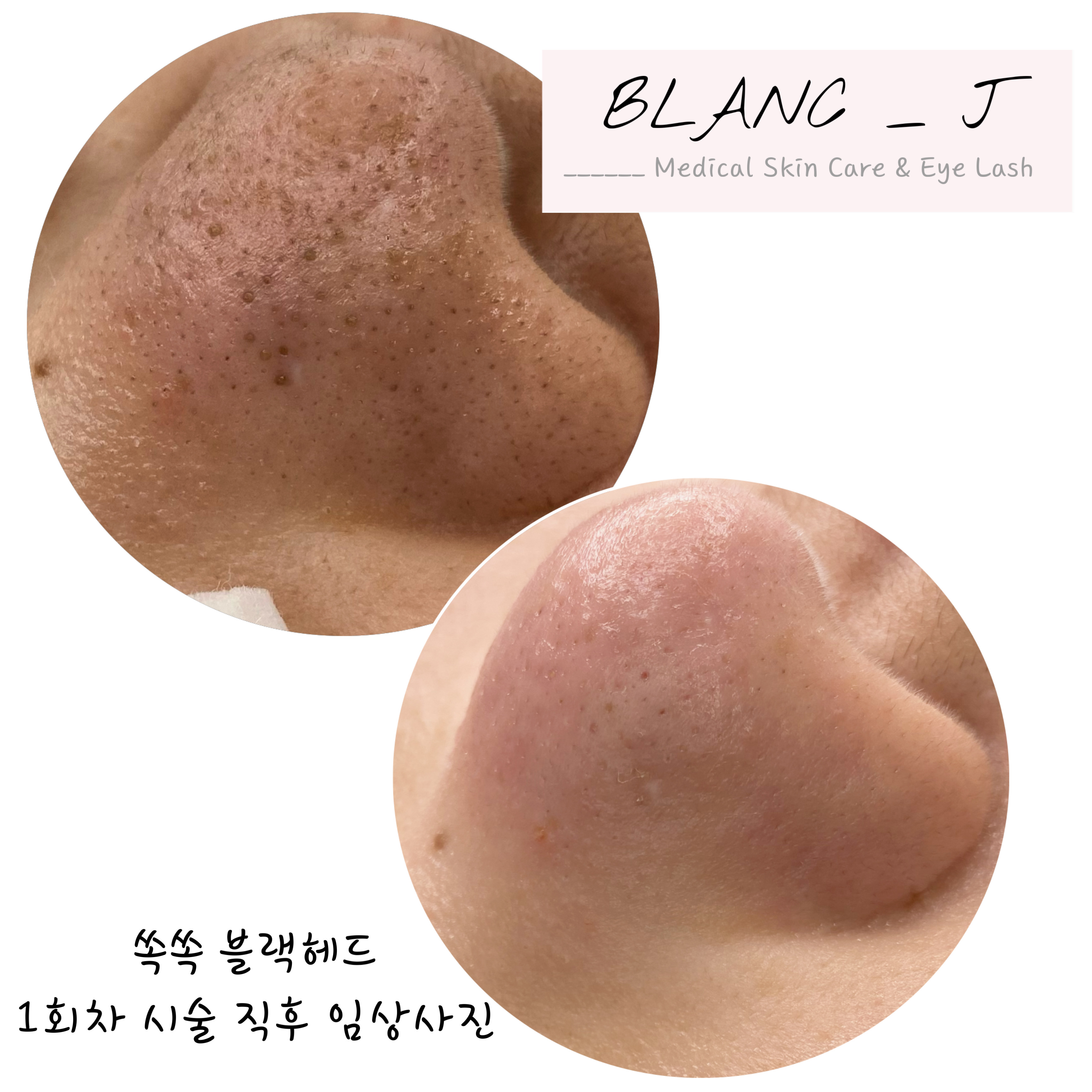 에스테틱 차온